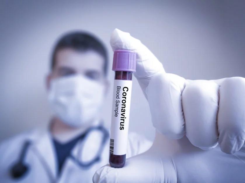 Polska firma bdzie sprzedawaa szybkie testy do wykrywania koronawirusa